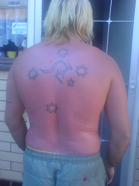 sunburnt a bit huh??