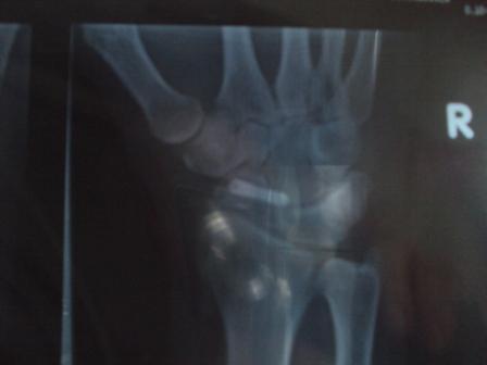 Just like the pros ha ha